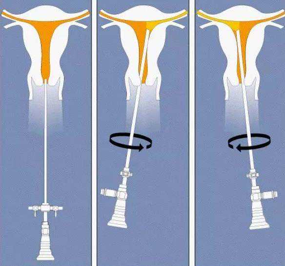 郑州试管婴儿的成功率是多少-郑州代生郑州代怀助孕指南